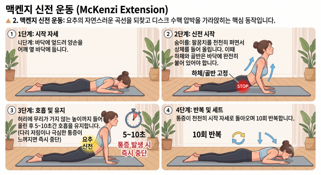 맥켄지 익스텐션 (허리 디스크 압박 감소)